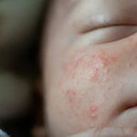 The Best Baby Towel for Delicate Skin: Why Your Choice of Bathing Towel Matters