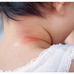 Heat Rashes & Prickly Heat: How to Keep Your Baby’s Skin Cool & Comfortable