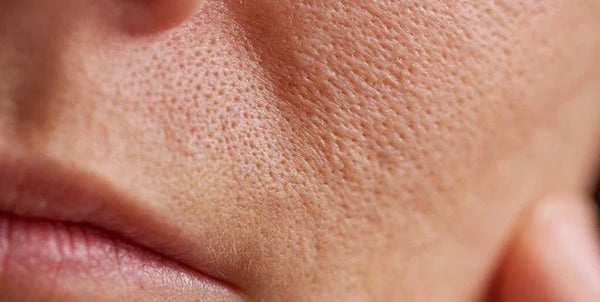 How to Keep Your Skin Hydrated and Protected During North Indian Winters