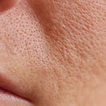 How to Keep Your Skin Hydrated and Protected During North Indian Winters