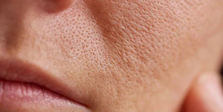 How to Keep Your Skin Hydrated and Protected During North Indian Winters
