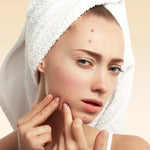 How to Clear Pimples on Face? - Doctor Towels
