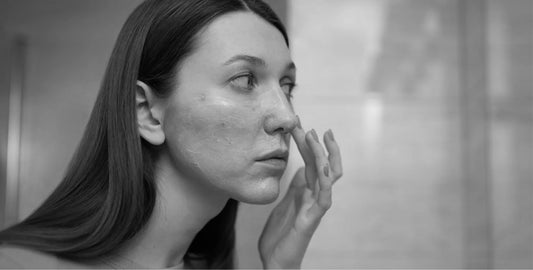 How Your Lifestyle Affects Your Sensitive Skin