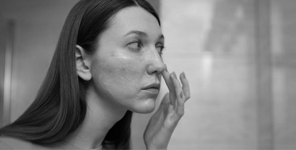 How Your Lifestyle Affects Your Sensitive Skin