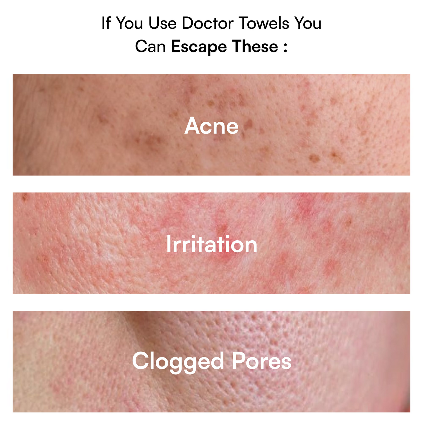 Acne-reduction Pack