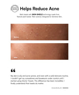 Advertisement for bath towels with skin-shield technology showing before and after effects on skin.