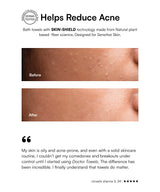 Advertisement for bath towels with Skin-Shield technology showing before and after effects on skin.